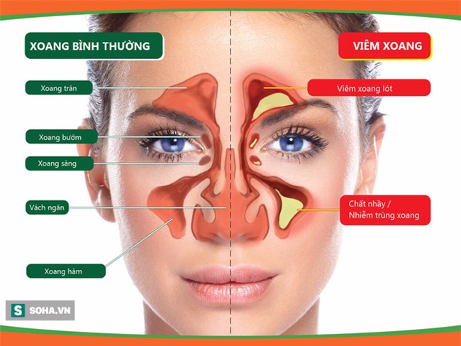Những nguyên nhân gây ra căn bệnh mở miệng hà hơi, tám làng bỏ chạy” - Ảnh 1.