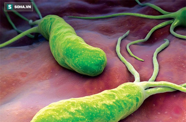 Chuyên gia chỉ rõ 4 nguyên nhân gây bệnh ung thư nguy hiểm nhất - Ảnh 1.