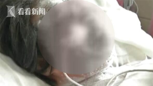 Phẫn nộ lý do con trai tạt axit khiến mẹ bị hủy hoại dung nhan và mù cả 2 mắt - Ảnh 1.