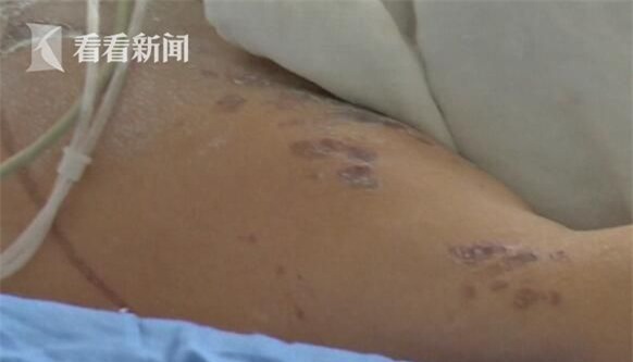 Phẫn nộ lý do con trai tạt axit khiến mẹ bị hủy hoại dung nhan và mù cả 2 mắt - Ảnh 2.