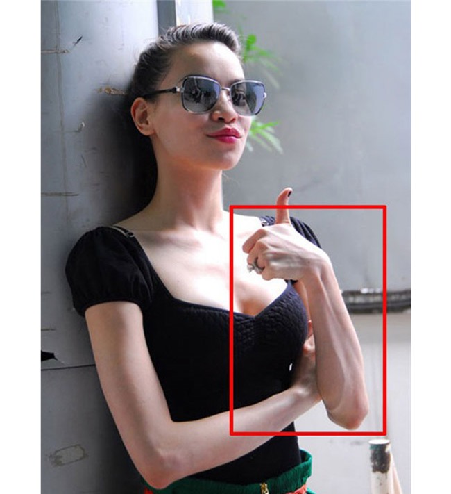 lo bung mo, dui phop phap va hang loat nhuoc diem cua my nu viet noi tieng nong bong - 13