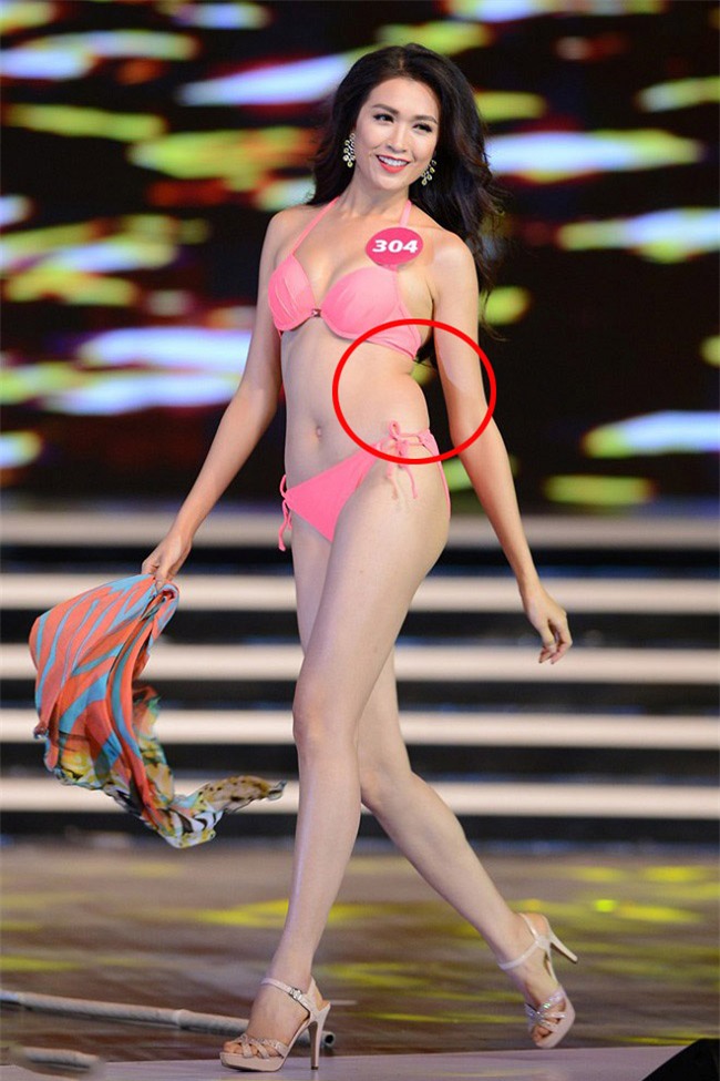 lo bung mo, dui phop phap va hang loat nhuoc diem cua my nu viet noi tieng nong bong - 8