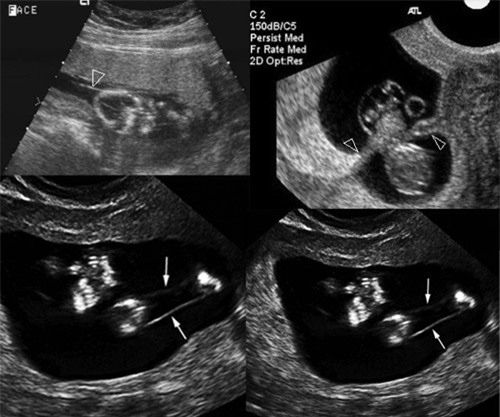 sieu am thai, me hoang so khi bac si noi ban tay con bi dai soi oi cat dut lia - 5