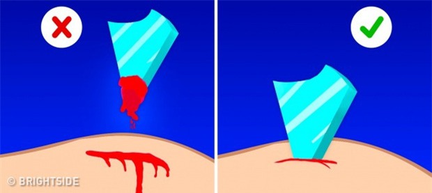 6 nhầm lẫn tai hại trong xử lý sơ cứu khiến bệnh càng nặng, vết thương càng đau - Ảnh 6.