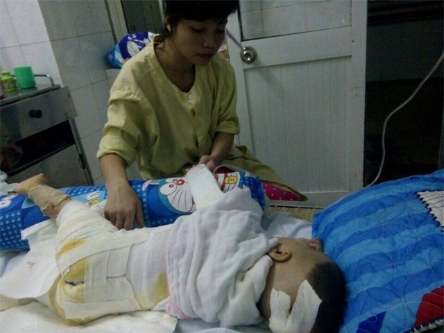 me an han vi so cuu bong sai cach khien con trai bi lot het ca da lung - 1