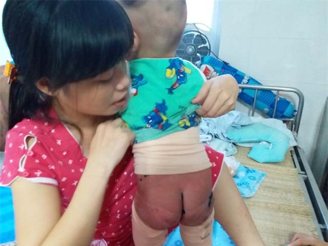 me an han vi so cuu bong sai cach khien con trai bi lot het ca da lung - 2