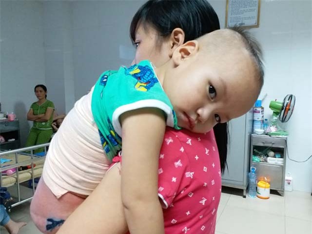 me an han vi so cuu bong sai cach khien con trai bi lot het ca da lung - 3