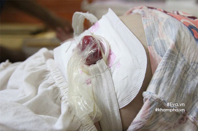 em be di bang “4 chan”, song nho vao nhung chiec bao cao su va bang ve sinh - 5