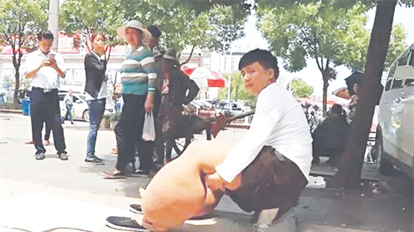 Giun chỉ bạch huyết: Căn bệnh không khác gì sốt xuất huyết - Ảnh 1.