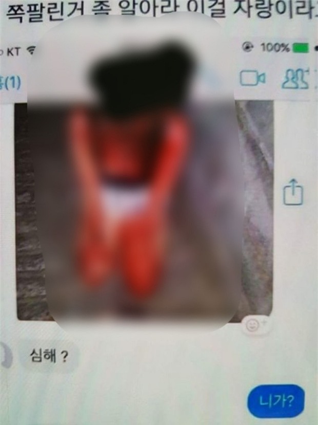 Hàn Quốc: Bị đàn chị quây đánh hội đồng, nữ sinh 14 tuổi toàn thân đầy máu, mặt mũi biến dạng phải quỳ gối hối lỗi - Ảnh 1.