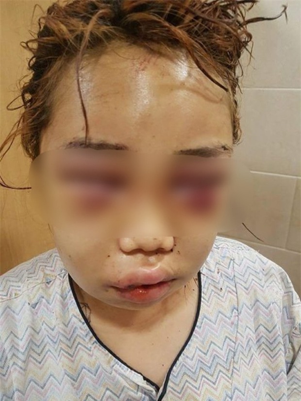 Hàn Quốc: Bị đàn chị quây đánh hội đồng, nữ sinh 14 tuổi toàn thân đầy máu, mặt mũi biến dạng phải quỳ gối hối lỗi - Ảnh 2.