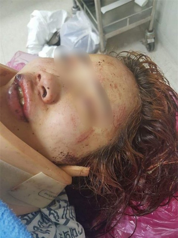 Hàn Quốc: Bị đàn chị quây đánh hội đồng, nữ sinh 14 tuổi toàn thân đầy máu, mặt mũi biến dạng phải quỳ gối hối lỗi - Ảnh 3.