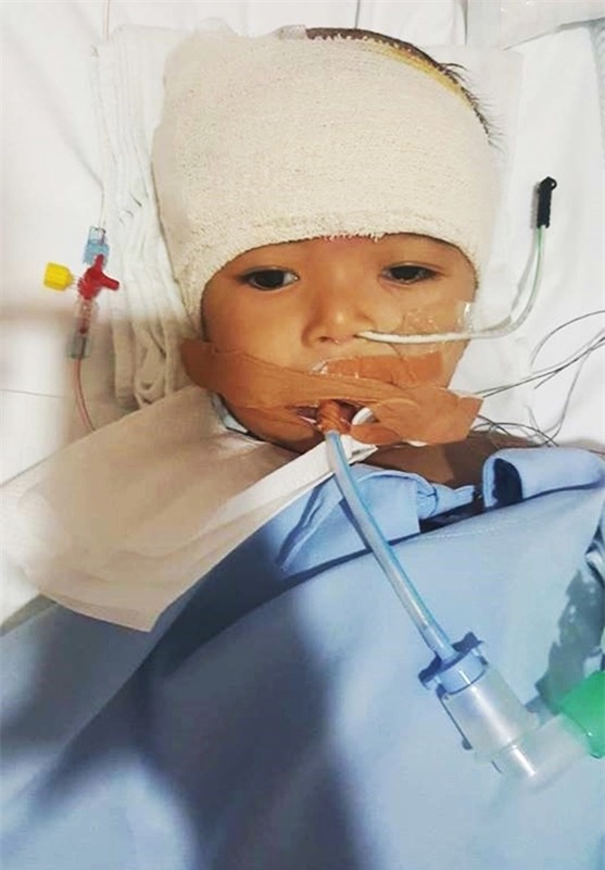 Lời kêu cứu của người vợ bị chồng bỏ rơi, con bệnh não úng thuỷ mấy lần chết hụt khi qua Singapore điều trị - Ảnh 1.