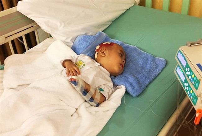 Lời kêu cứu của người vợ bị chồng bỏ rơi, con bệnh não úng thuỷ mấy lần chết hụt khi qua Singapore điều trị - Ảnh 9.