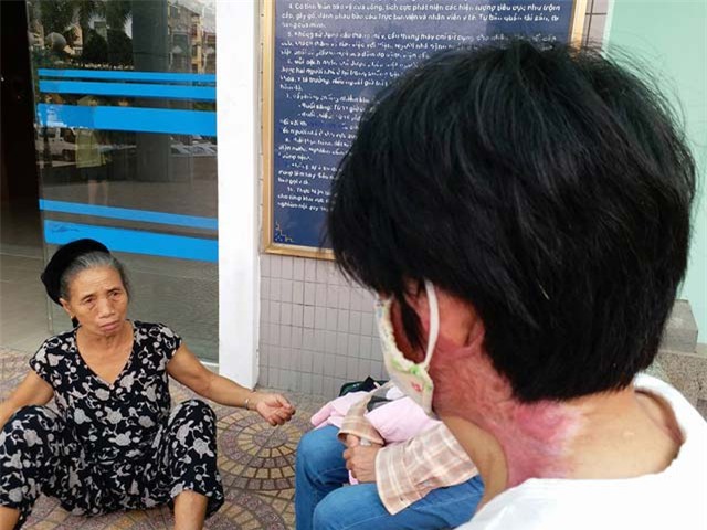 co gai bi chong tam xang dot: "khong dam gap con vi so con hoang loan khi nhin thay me" - 1