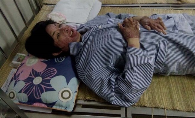 co gai bi chong tam xang dot: "khong dam gap con vi so con hoang loan khi nhin thay me" - 6