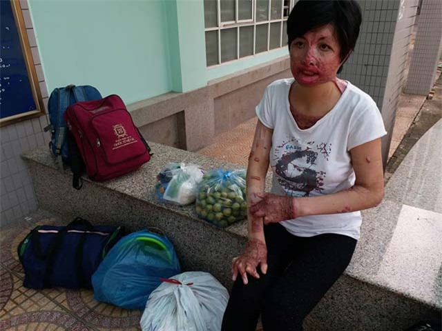 co gai bi chong tam xang dot: "khong dam gap con vi so con hoang loan khi nhin thay me" - 7