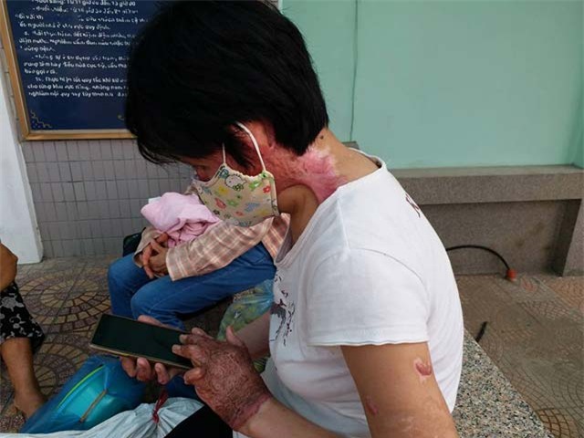 co gai bi chong tam xang dot: "khong dam gap con vi so con hoang loan khi nhin thay me" - 8