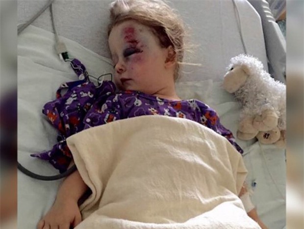 Con gái ngủ trưa, mẹ nghe hàng xóm đập cửa ầm ĩ và sững sờ nhìn con bất động - Ảnh 2.