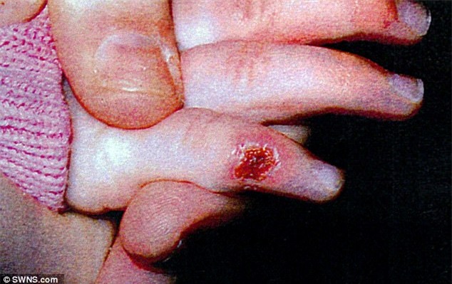 Bé 21 tháng bị mẹ đẻ nhẫn tâm đạp gãy xương sườn, tự cắn phải lưỡi chết tức tưởi - Ảnh 4.