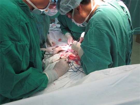 Lần đầu tiên ghép thận cho người lớn tuổi nhất Việt Nam - Ảnh 1.
