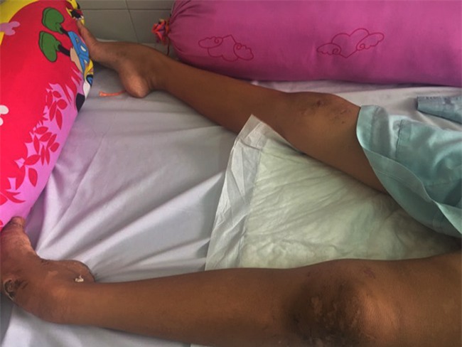 goa phu cay dang truoc canh con gai bi chan thuong so nao, luc tinh luc me - 3