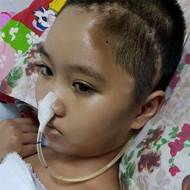 goa phu cay dang truoc canh con gai bi chan thuong so nao, luc tinh luc me - 4