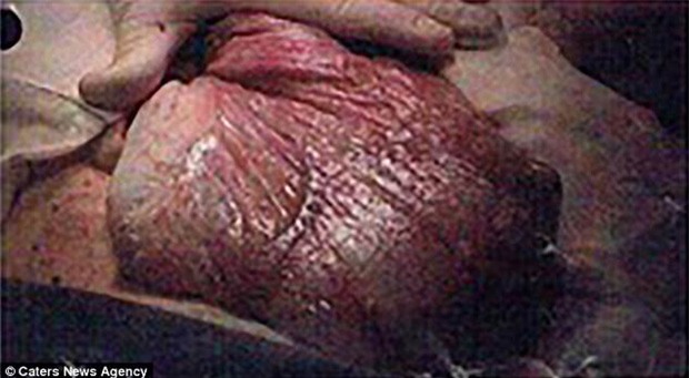 Tưởng mang bầu 8 tháng, bà mẹ giật mình phát hiện thứ kinh dị này trong bụng - Ảnh 3.