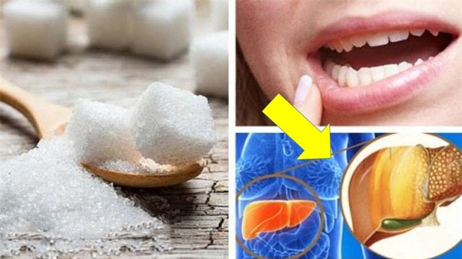 Bạn sẽ không ngờ những tác hại khi ăn nhiều đường lại nghiêm trọng thế này - Ảnh 1.