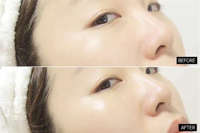 Đánh giá 1 số dòng kem mắt từ bình dân đến cao cấp phổ biến trên thị trường - Ảnh 8.