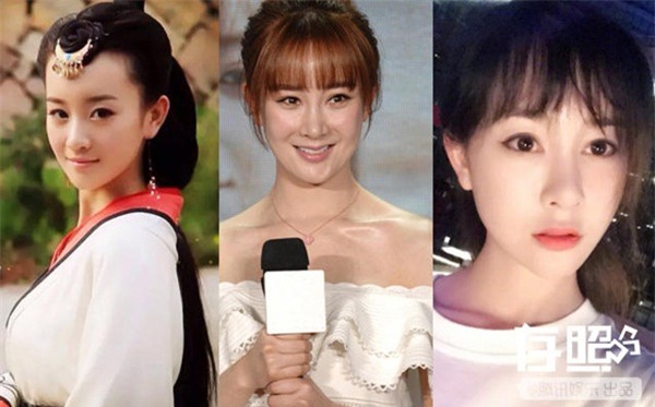 phau thuat tham my that bai sao hoa ngu kho cuc tim ve nhan sac ban dau - 3