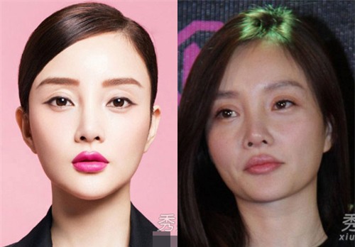 phau thuat tham my that bai sao hoa ngu kho cuc tim ve nhan sac ban dau - 5