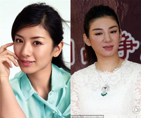 phau thuat tham my that bai sao hoa ngu kho cuc tim ve nhan sac ban dau - 7