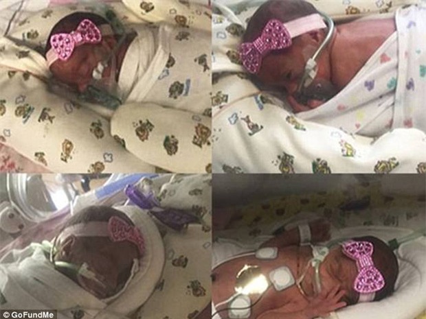 Bà mẹ may mắn nhất quả đất, cứ mỗi lần siêu âm lại phát hiện thêm một em bé trong bụng - Ảnh 3.