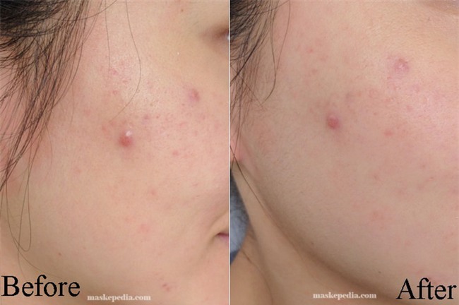 Mặt nạ Naruko đang hot khắp các diễn đàn, và đây là tường tận review  - Ảnh 5.