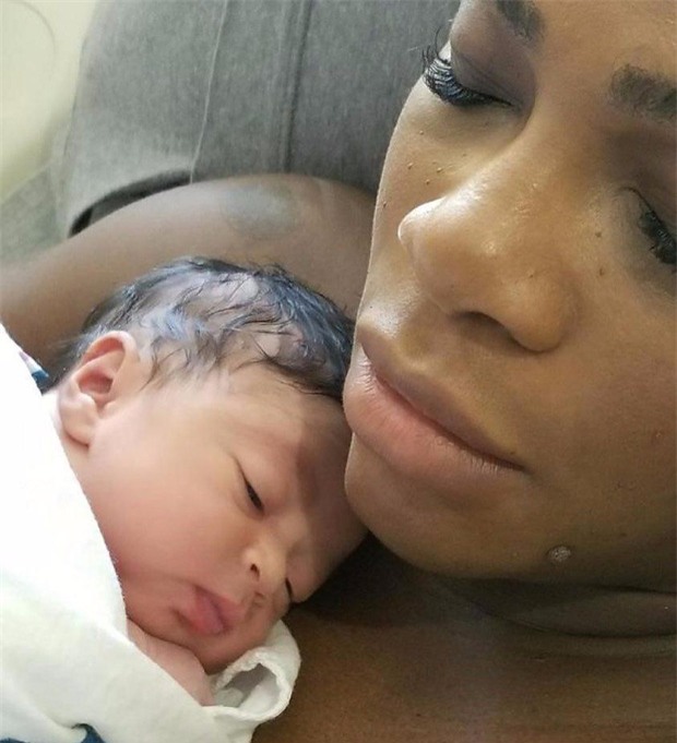 Serena Williams xúc động lần đầu khoe ảnh con gái mới chào đời - Ảnh 2.