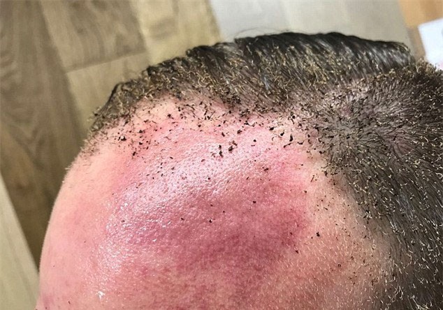 nổ ở London, tàu điện ngầm, khủng bố