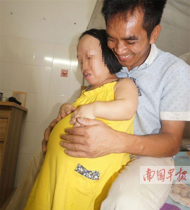 bat chap nguy hiem, nguoi phu nu cao 91cm nhu dua tre len ba mang bau vuot mat - 1