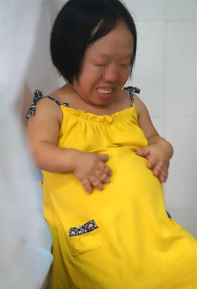 bat chap nguy hiem, nguoi phu nu cao 91cm nhu dua tre len ba mang bau vuot mat - 2