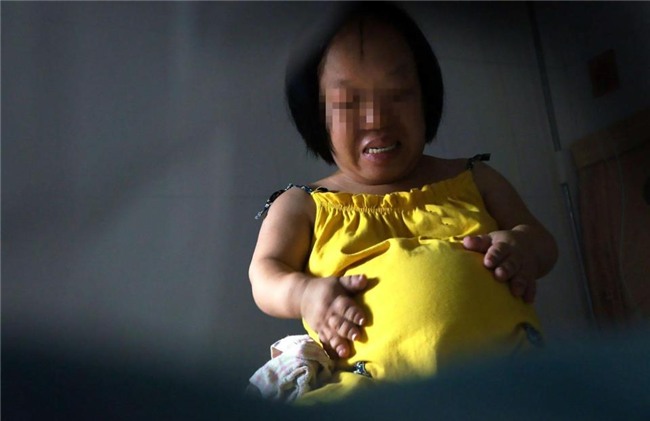 bat chap nguy hiem, nguoi phu nu cao 91cm nhu dua tre len ba mang bau vuot mat - 3