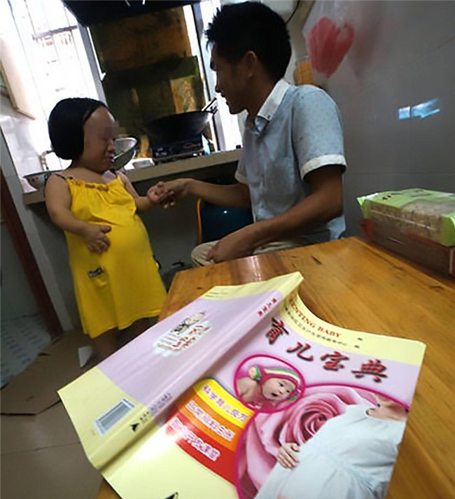 bat chap nguy hiem, nguoi phu nu cao 91cm nhu dua tre len ba mang bau vuot mat - 6