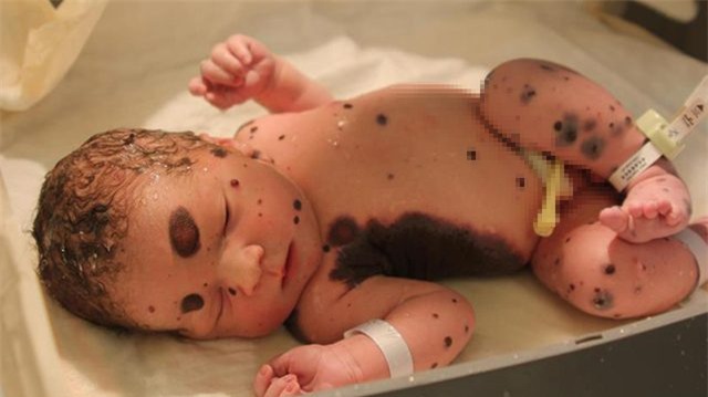 bi goi la 'quai vat', cau be sinh ra khap nguoi kin not ruoi 5 nam truoc gio ra sao? - 1