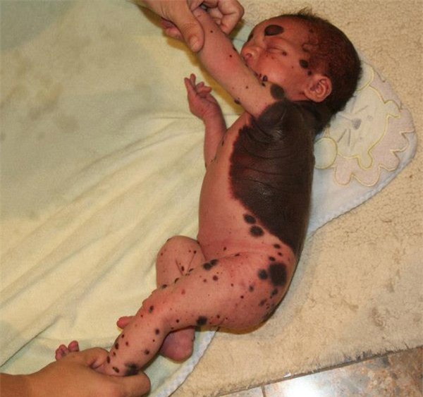 bi goi la 'quai vat', cau be sinh ra khap nguoi kin not ruoi 5 nam truoc gio ra sao? - 2