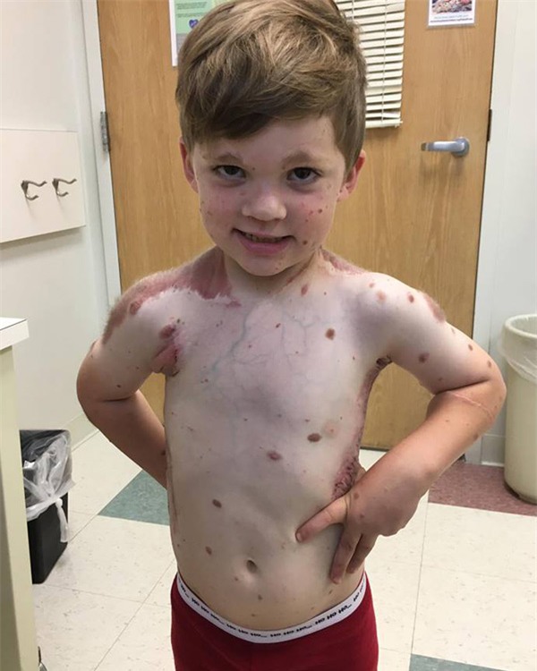 bi goi la 'quai vat', cau be sinh ra khap nguoi kin not ruoi 5 nam truoc gio ra sao? - 3