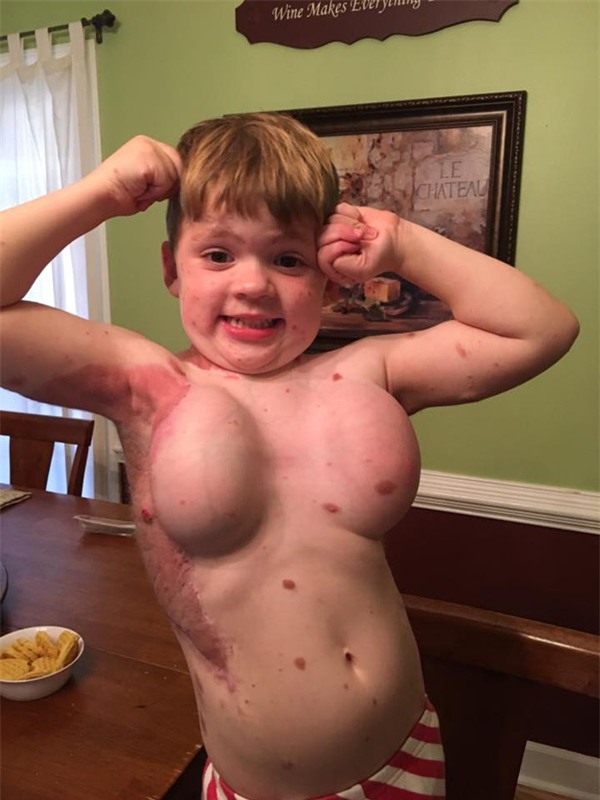 bi goi la 'quai vat', cau be sinh ra khap nguoi kin not ruoi 5 nam truoc gio ra sao? - 5