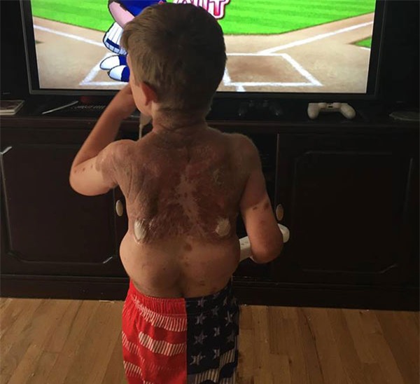 bi goi la 'quai vat', cau be sinh ra khap nguoi kin not ruoi 5 nam truoc gio ra sao? - 6