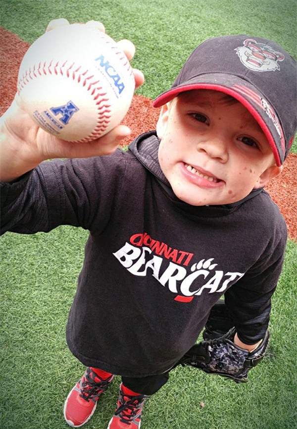 bi goi la 'quai vat', cau be sinh ra khap nguoi kin not ruoi 5 nam truoc gio ra sao? - 7