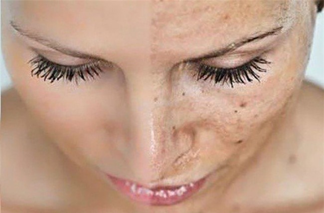 uống nước, uống nước chanh, uống nước ấm, giảm đau, giảm béo, thanh lọc cơ thể, đẹp da, làm đẹp