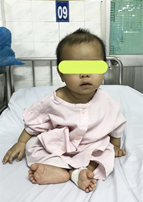 Phụ huynh cẩn trọng: Giật hoa tai của mẹ nuốt vào bụng, bé gái 7 tháng tuổi bị rách thực quản - Ảnh 3.