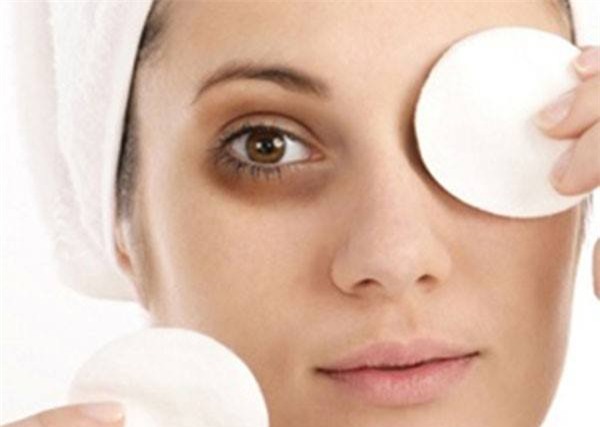 ung thư da, bệnh rosacea, đau tim, huyết khối tĩnh mạch